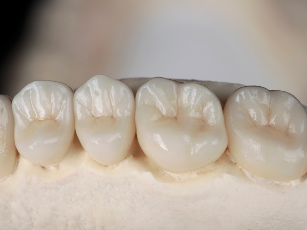 young couple smiling on couch l dental crowns wilmington