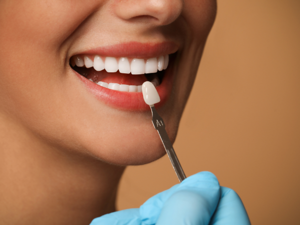 man with curly hair smiling l veneers wilmington