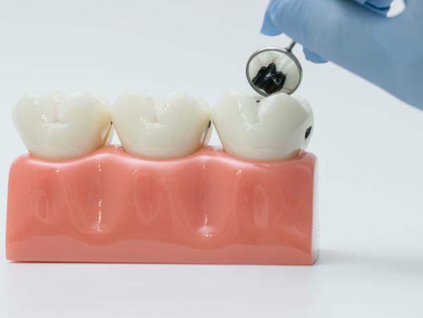 preventative dentistry | wilmington de