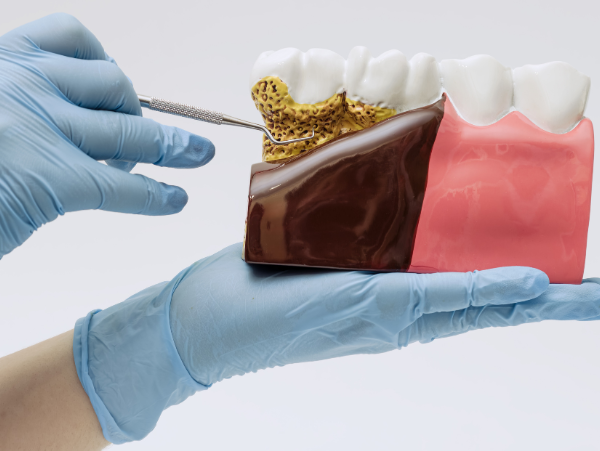 close up of toothbrush | gum disease wilmington de
