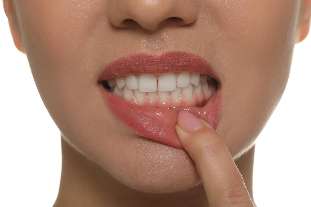 A woman showing her teeth