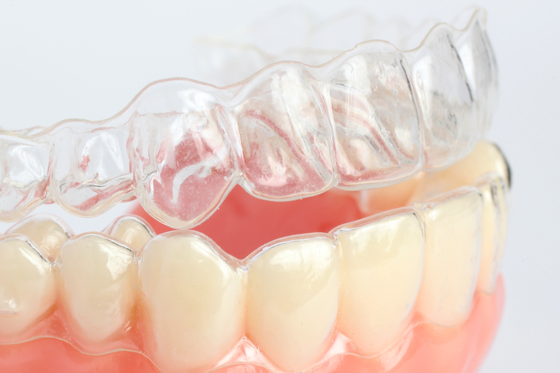 close up of invisalign clear aligner on mouth mold in wilmington