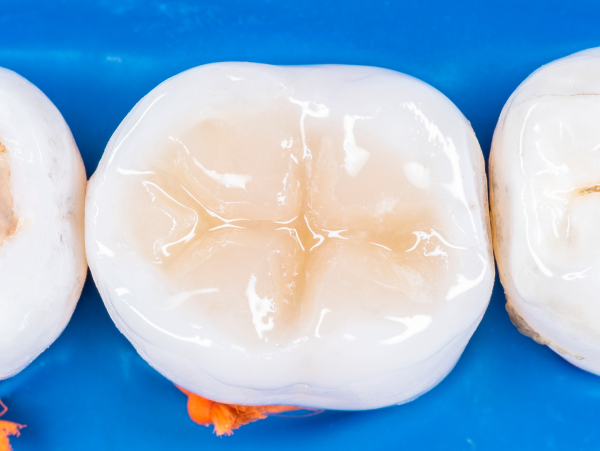 man sitting in dental exam chair | dentist wilmington de