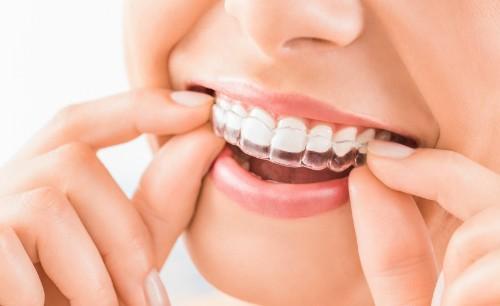 invisalign | orthodontics | wilmington de