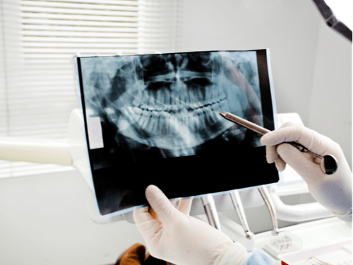 close up xray at dentist office in wilmington de