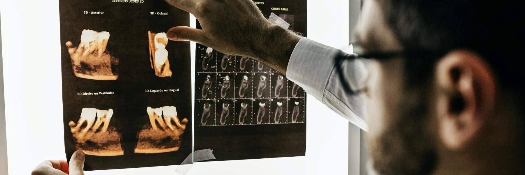dentist looking at dental x-ray l Drs. Justison and Gladnick