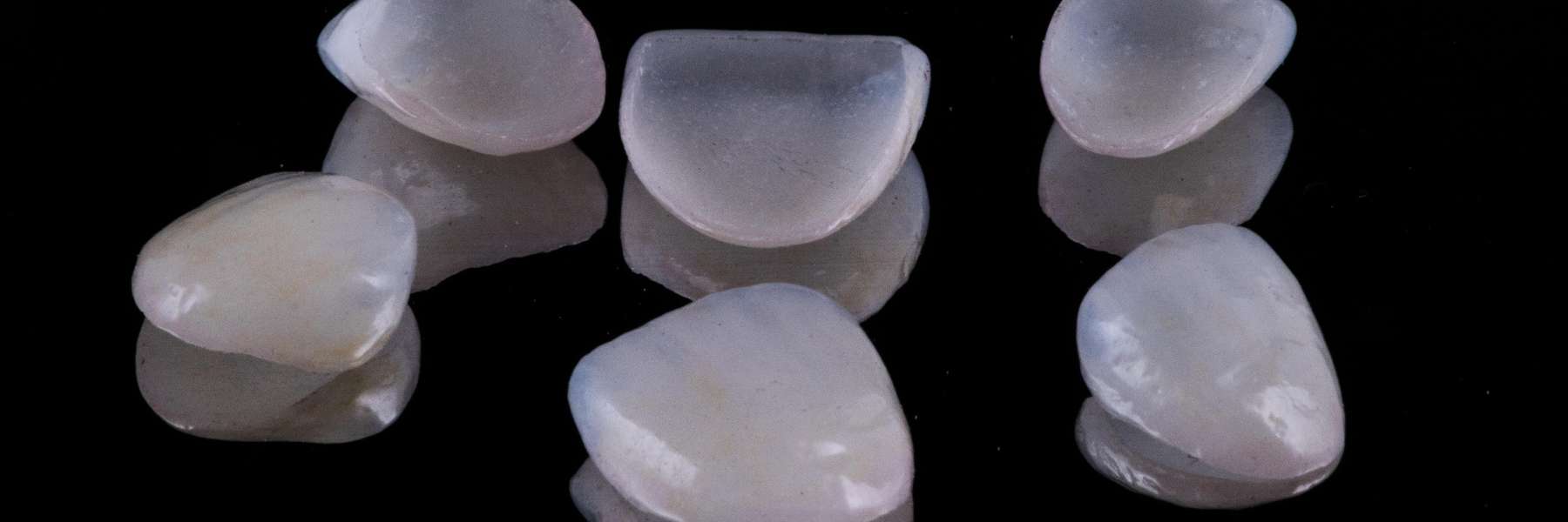 Dental Veneers in Wilmington Delaware