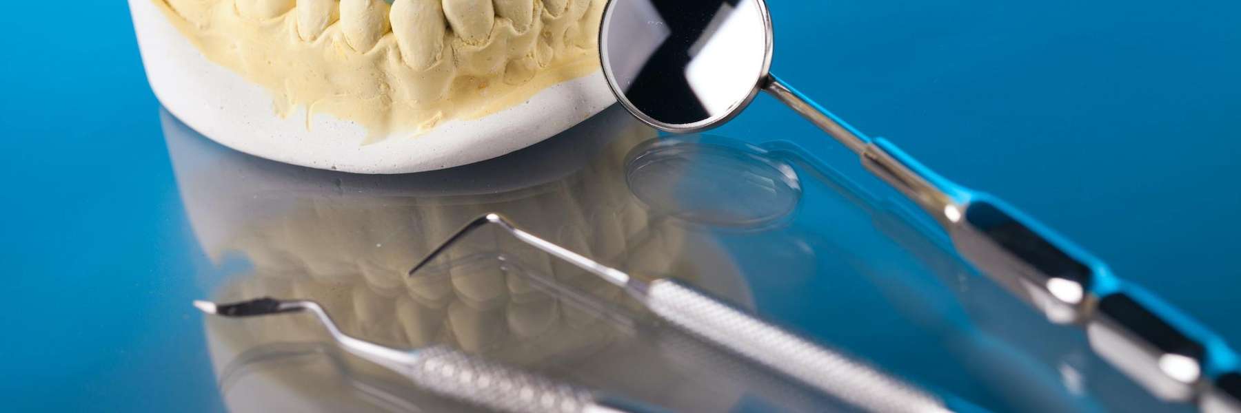 A dental mold and dental tools | Wilmington Delaware dentist