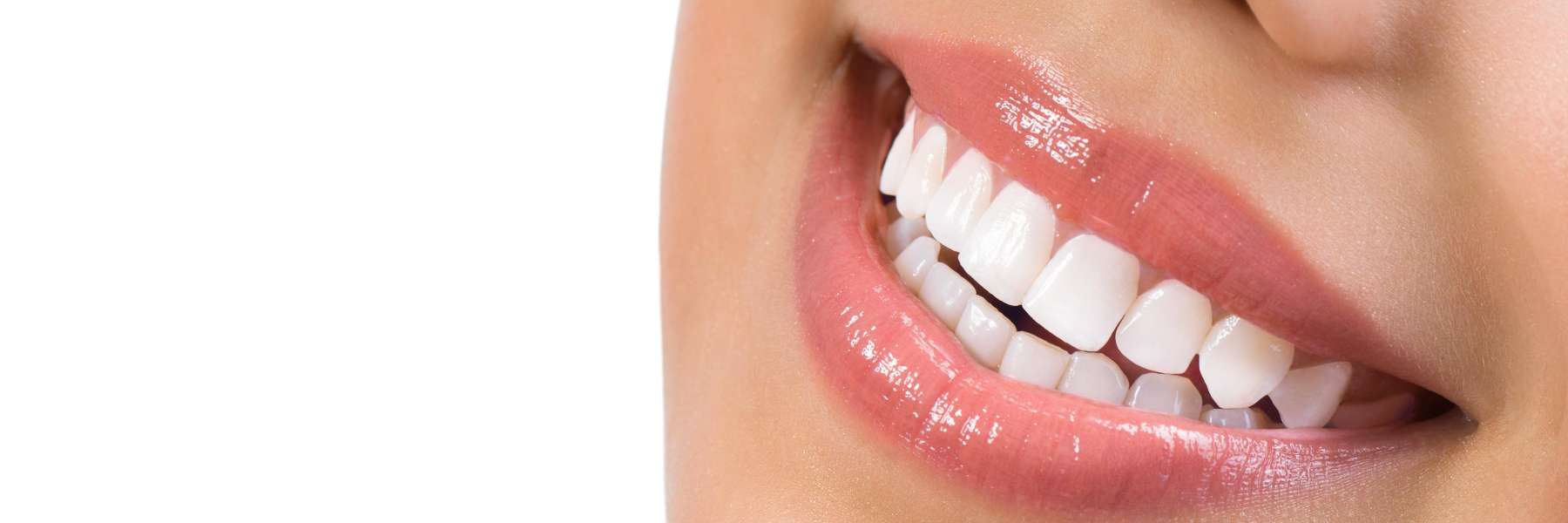 A woman showing her healthy, white teeth in Wilmington, DE
