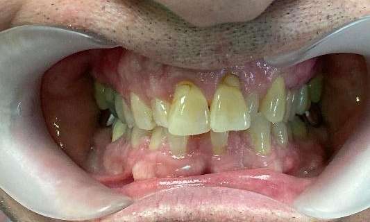 The-Smile-He-s-Always-Wanted-Before-Image