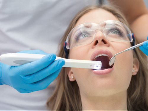 Intra-Oral Camera