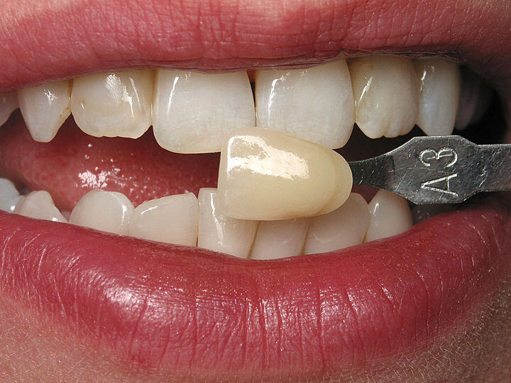 Patient smile after treatment at Justison and Gladnick Family Dentistry