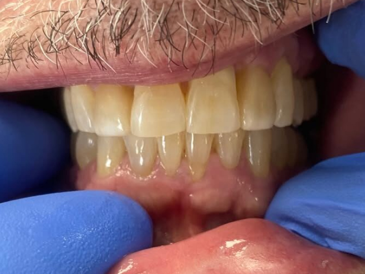 Patient smile after treatment at Justison and Gladnick Family Dentistry