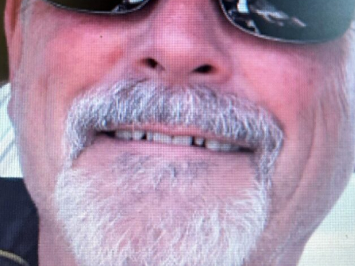 Patient smile before treatment at Justison and Gladnick Family Dentistry