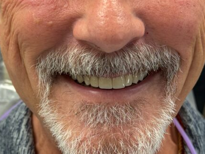 Patient smile after treatment at Justison and Gladnick Family Dentistry